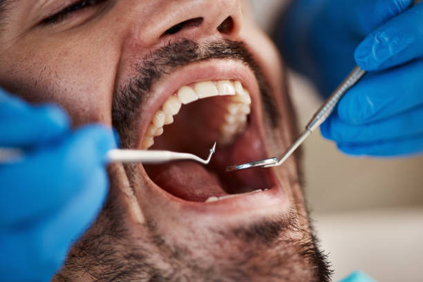 Dentist for Dental Trauma in MO